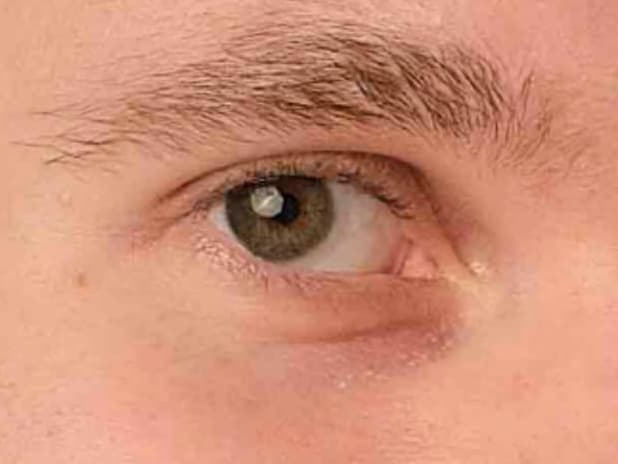 Sguardo 18