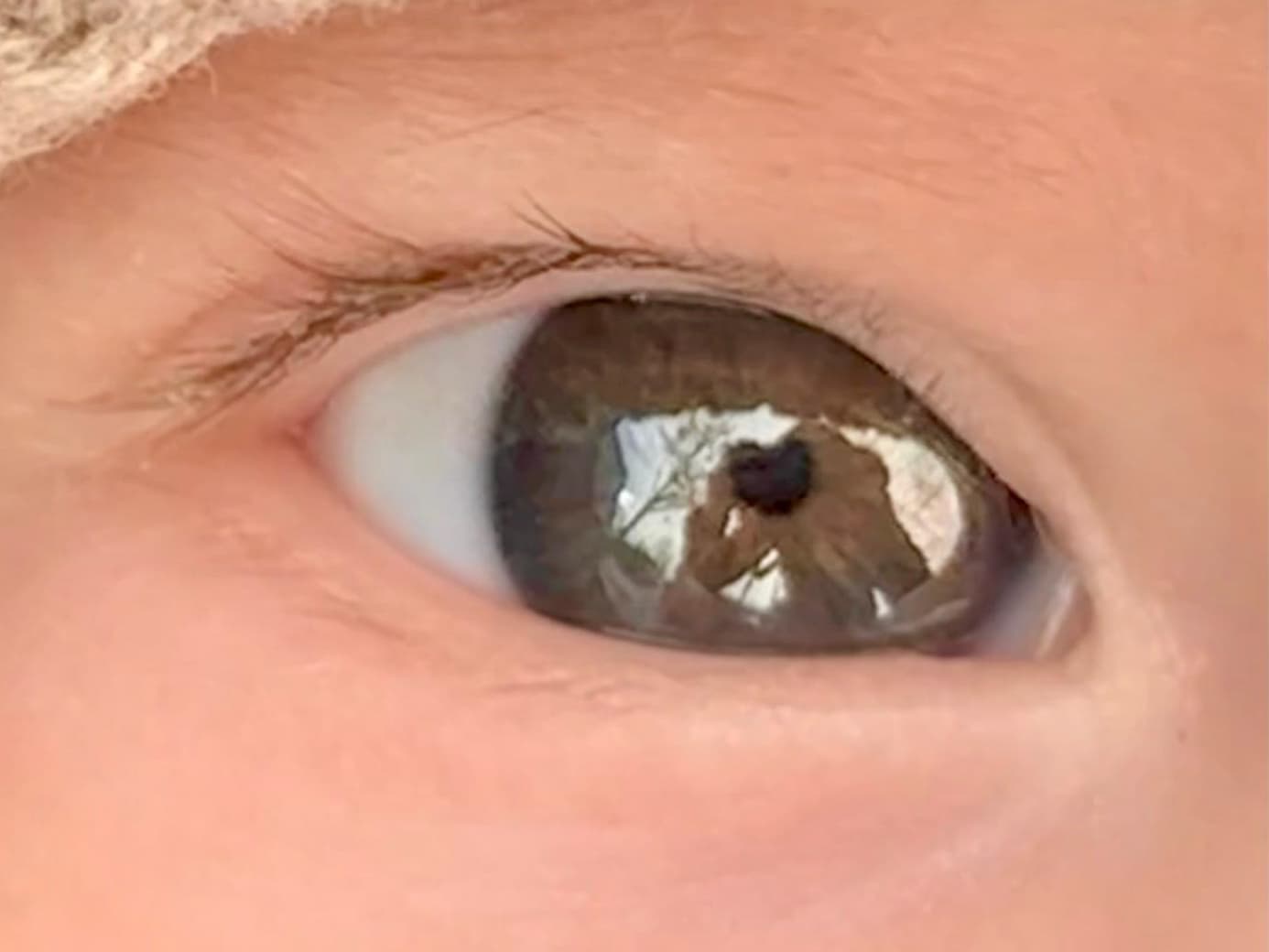 Sguardo 0